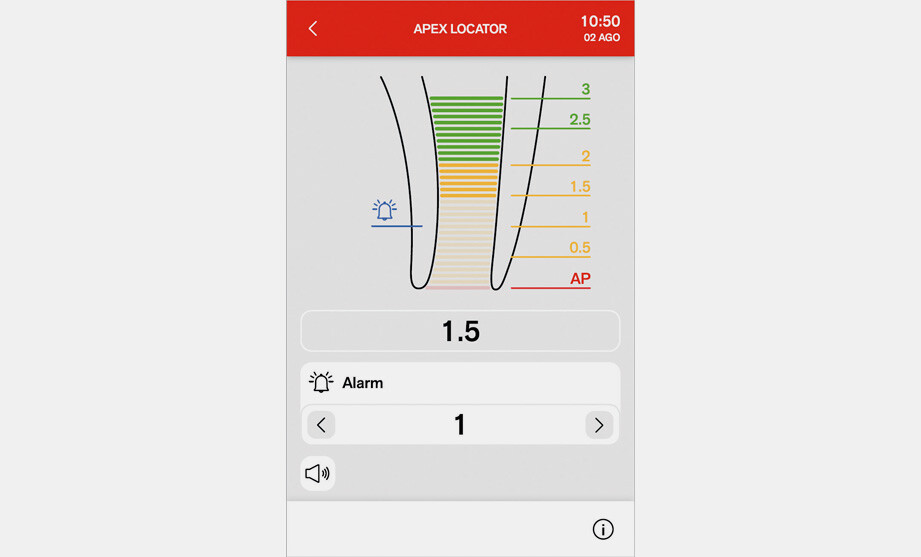 apex locator